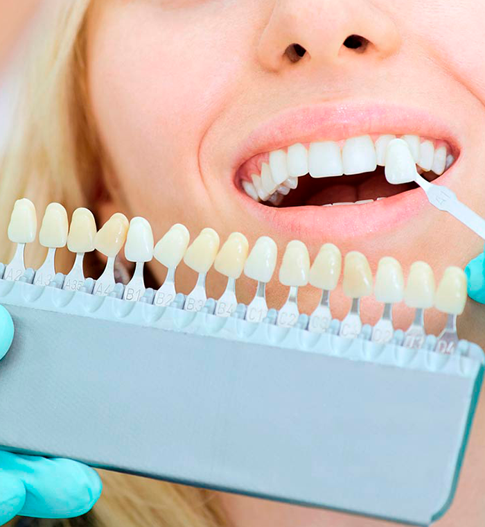 branqueamentodentario